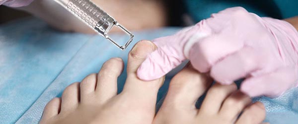 Грибкове ураження 4